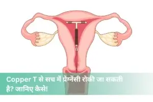 Copper T kya hai, kaise lagti hai, nikalne ka tarika, fayde-nuksan aur keemat – Copper T in Hindi
